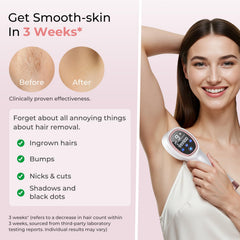 Ubroo IPL laser underarms use demonstrating quick, comfortable sessions