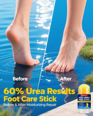 VANUZITARA Travel-friendly Urea Stick fits bags and on-the-go care.