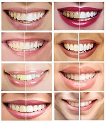 White Teeth Global tray-not-included notice for separate tray pairing.