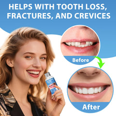 XLMCWT color matching beads close to real tooth shade