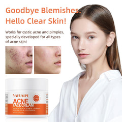 YAFUSIPE acne treatment cream close-up displaying smooth, moisturized texture.
