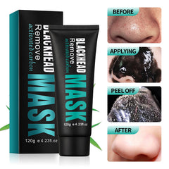 YAFUSIPE blackhead removal tools kit for at home blemish extraction.