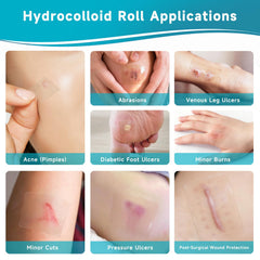 Yarster hydrocolloid roll ultra-absorbent layer helps manage moisture.