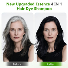 Yuolita herbal formula bottle highlighting 4-in-1 benefits for hair.
