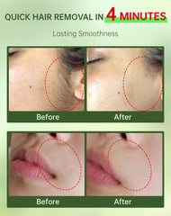Zeponyx 2 in 1 kit with soothing cream for post removal calm