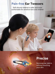 ZERONDER i35R painless ear tweezers for gentle wax removal