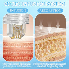 ZJRUI Microneedling roller in use shows enhanced serum absorption and refreshed skin