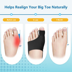 ZRCZRC bunion corrector features 3D gel cushioning for gentle toe support.