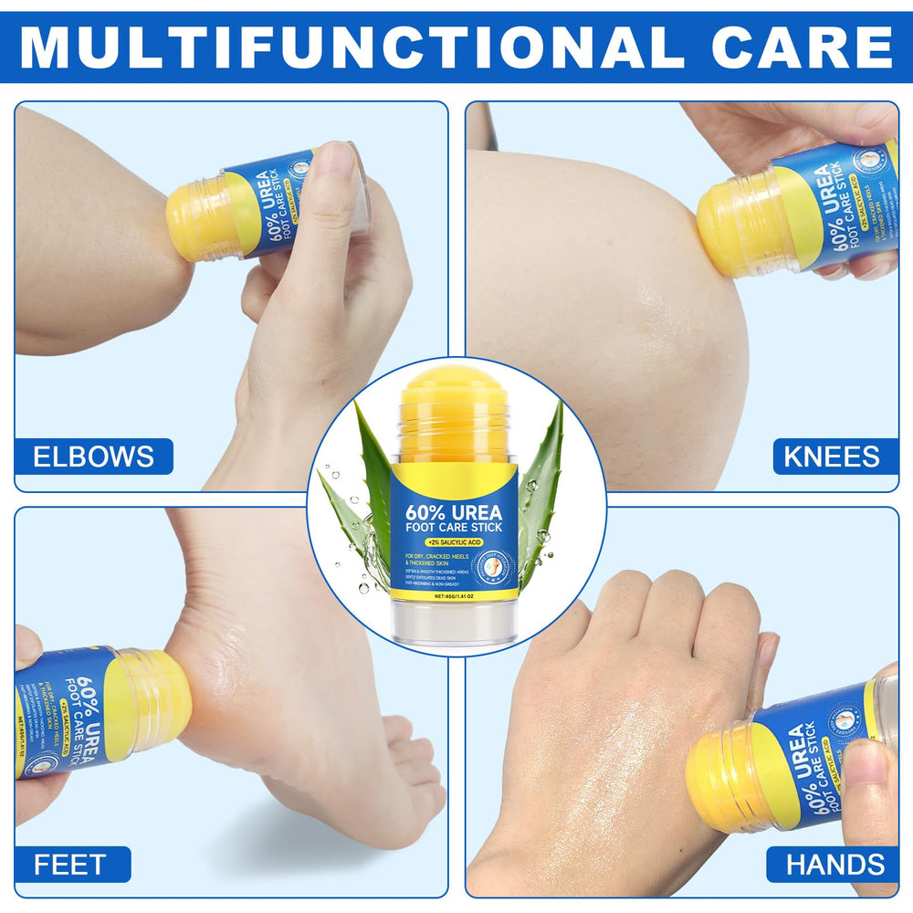 60% Urea Cream Stick callus softening on hard skin.