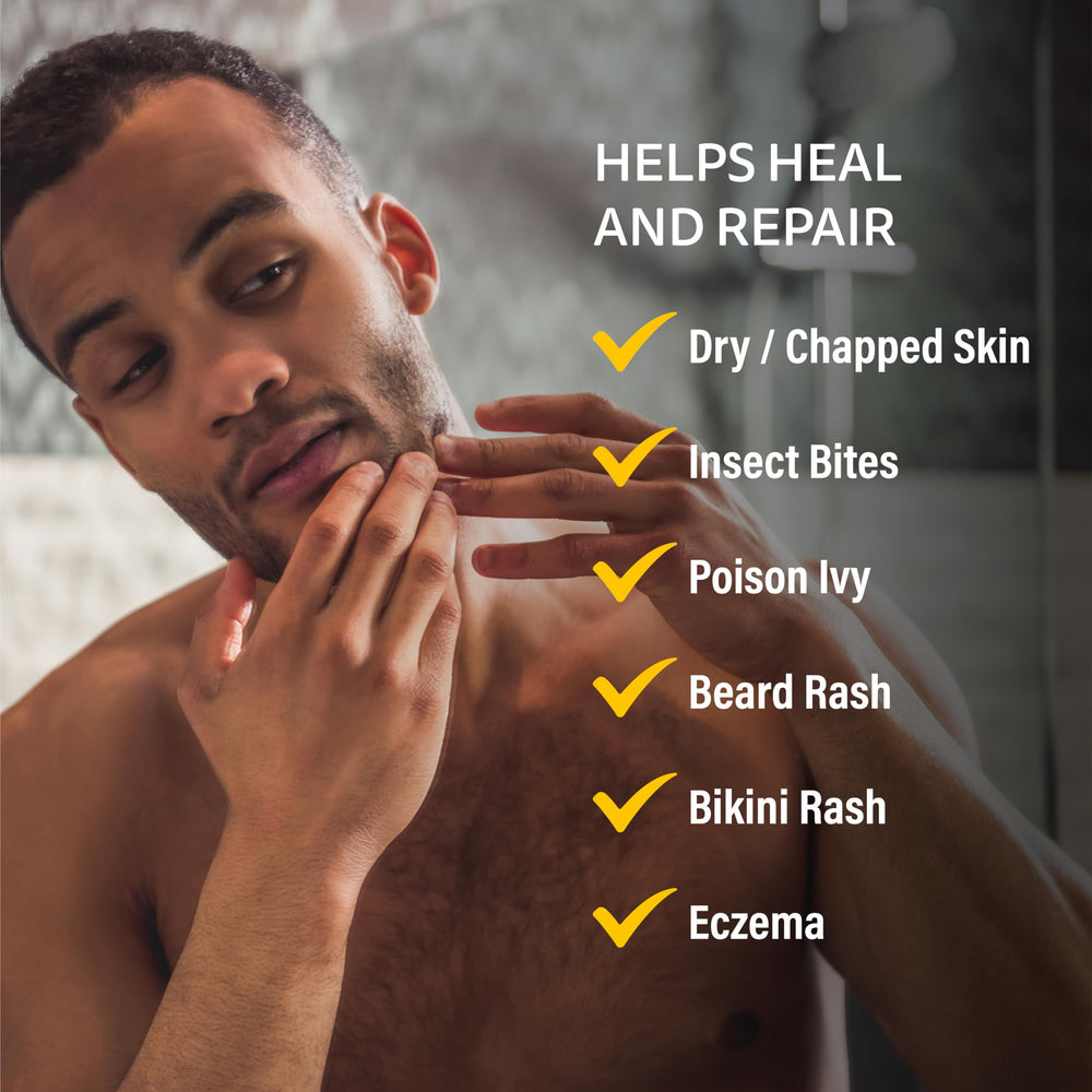 A+D Medicated Rash Ointment promotes healthier-looking skin after irritation.