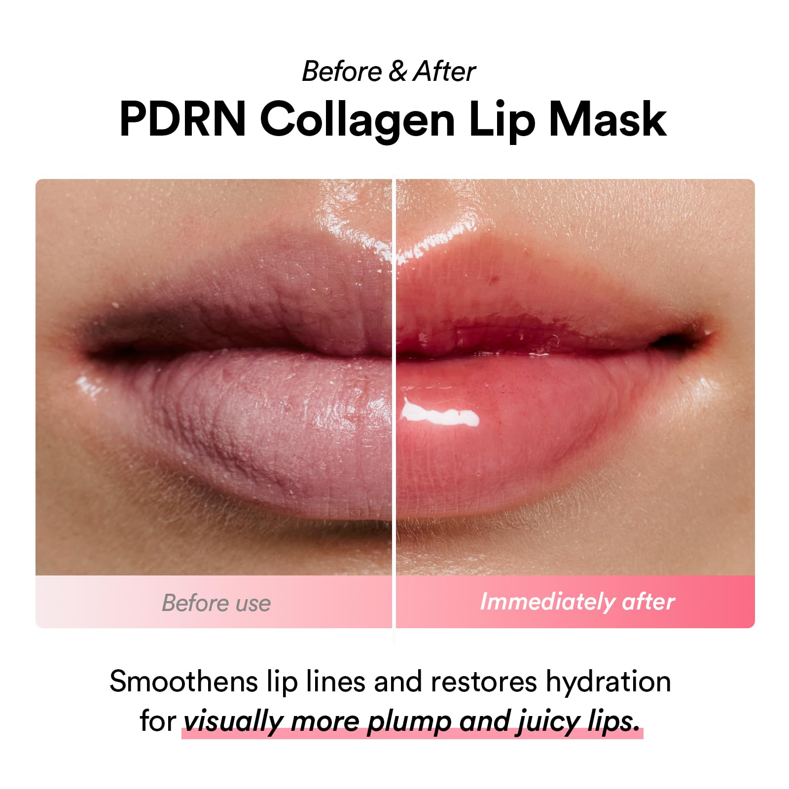 Abib PDRN 3D collagen complex illustration highlighting plump, hydrated lips.