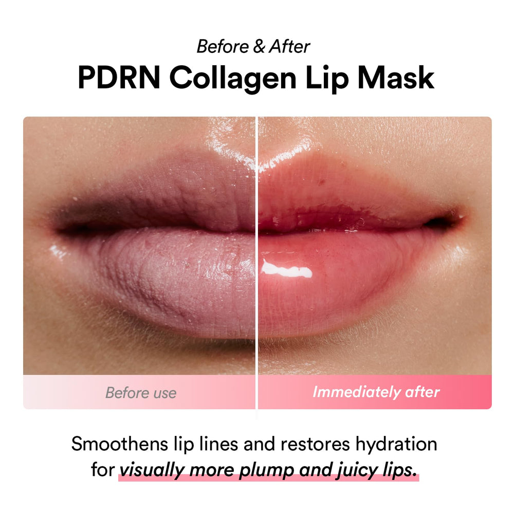 Abib PDRN 3D collagen complex illustration highlighting plump, hydrated lips.