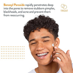 AcneFree Terminator 10 ginger-chamomile close-up, soothing redness while treating active blemishes.