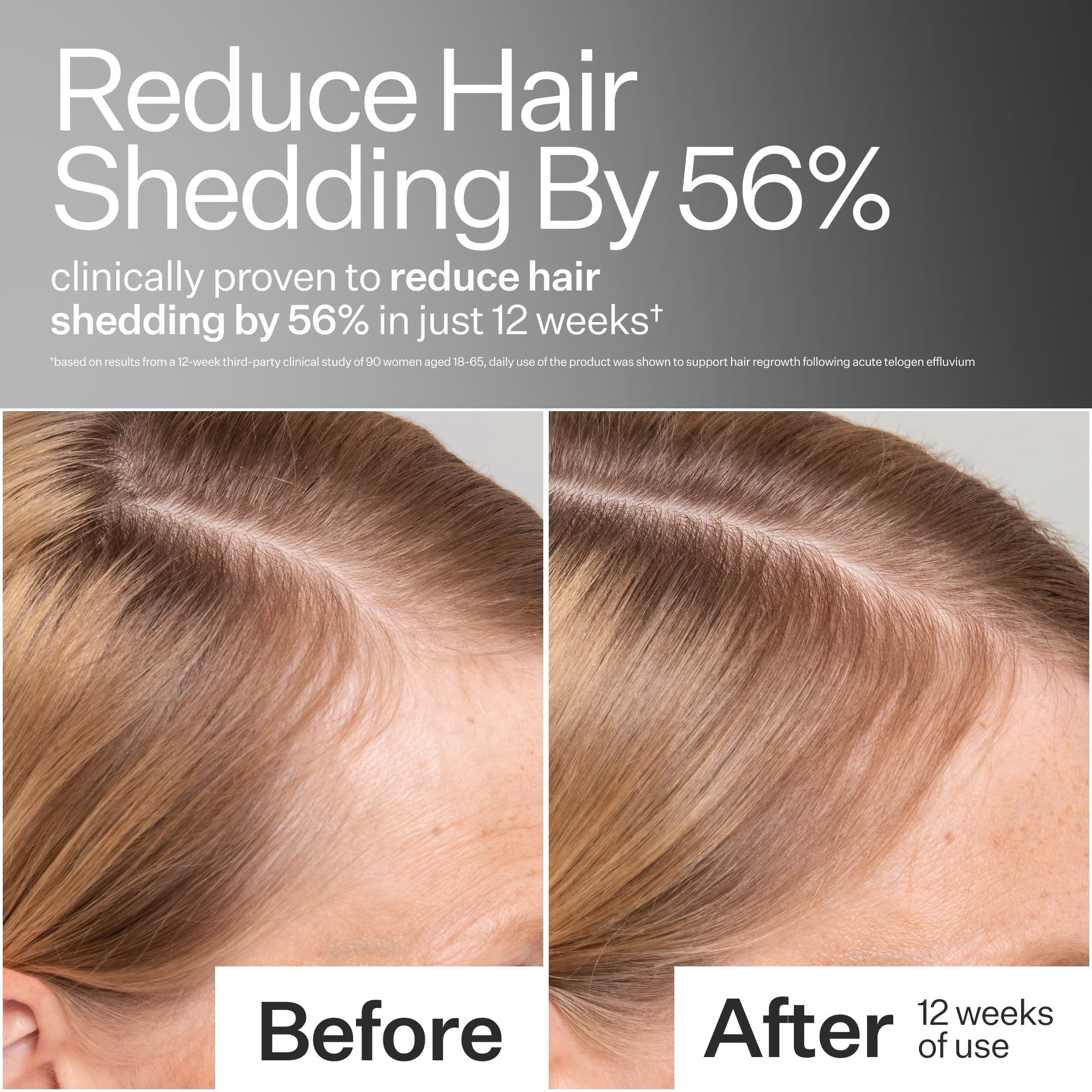 ACT+ ACRE serum pipette dispenses evenly for easy daily scalp application.