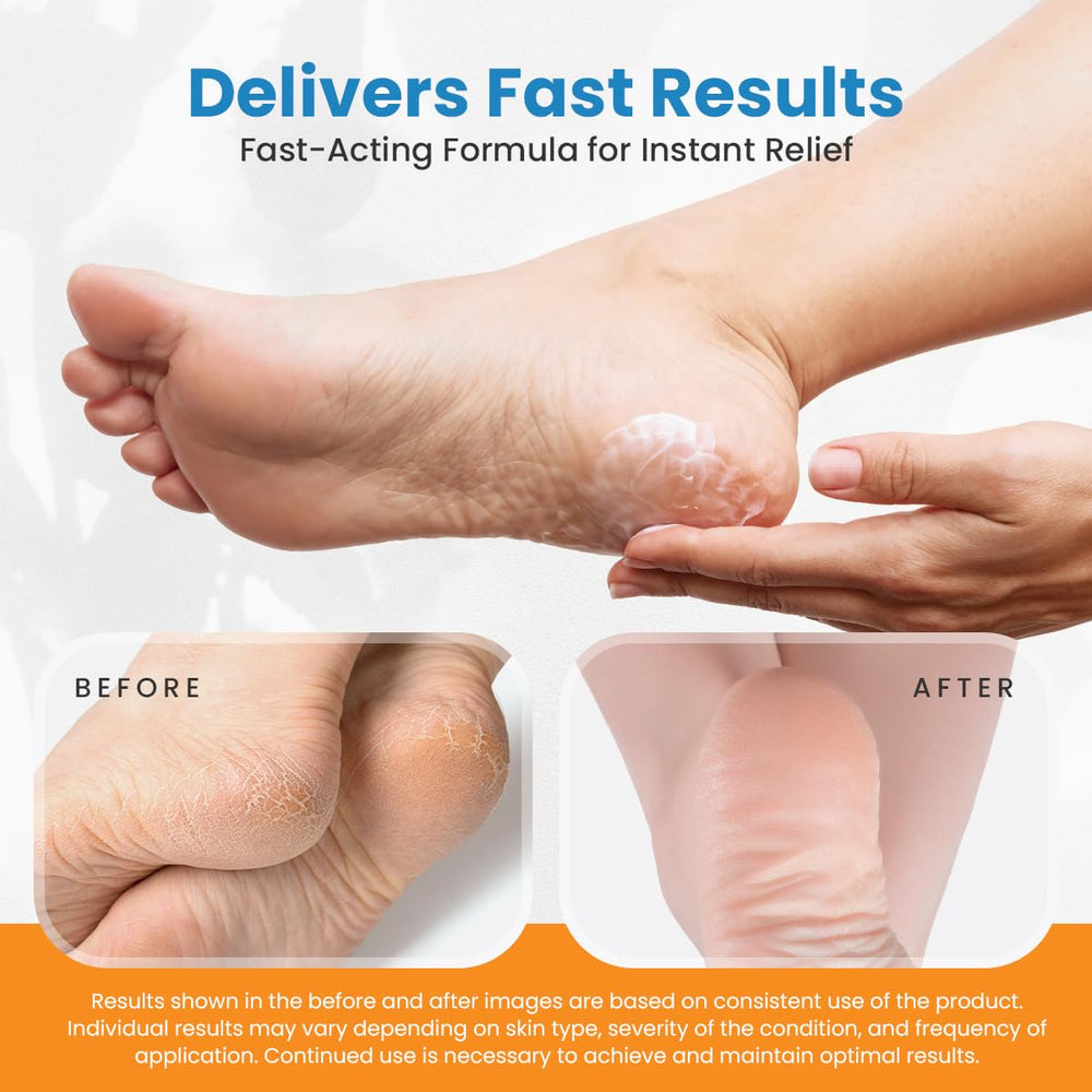 Exfoliating brush included for a complete foot care routine