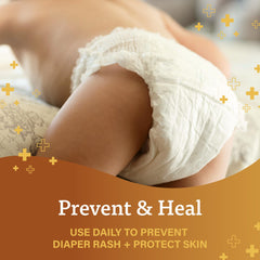 Pediatrician-approved A+D ointment indicated for delicate skin care.