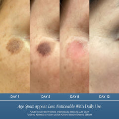 Admire My Skin Kojic and Azelaic acid serum highlights clarifying ingredients.