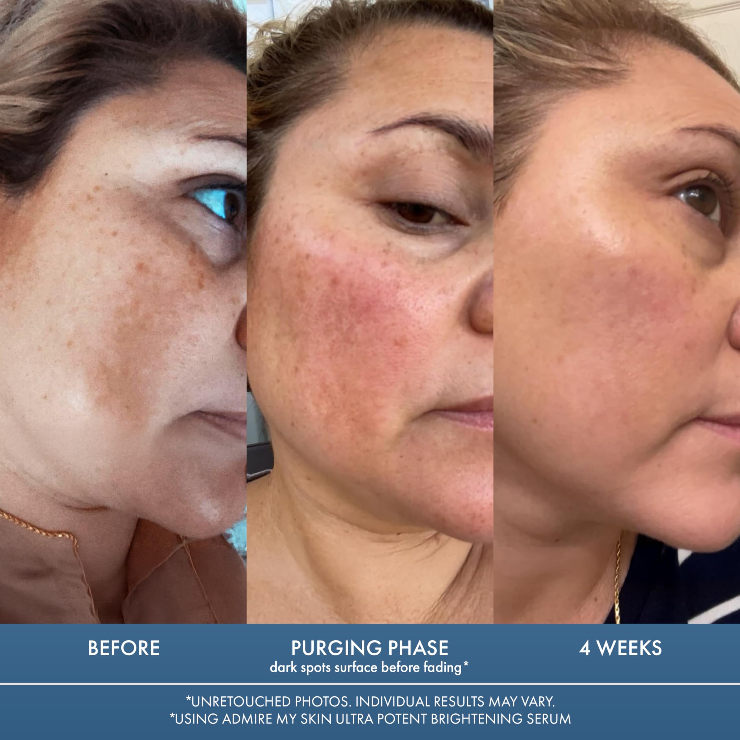 Admire My Skin serum texture swirl on skin showcases smoothing finish.