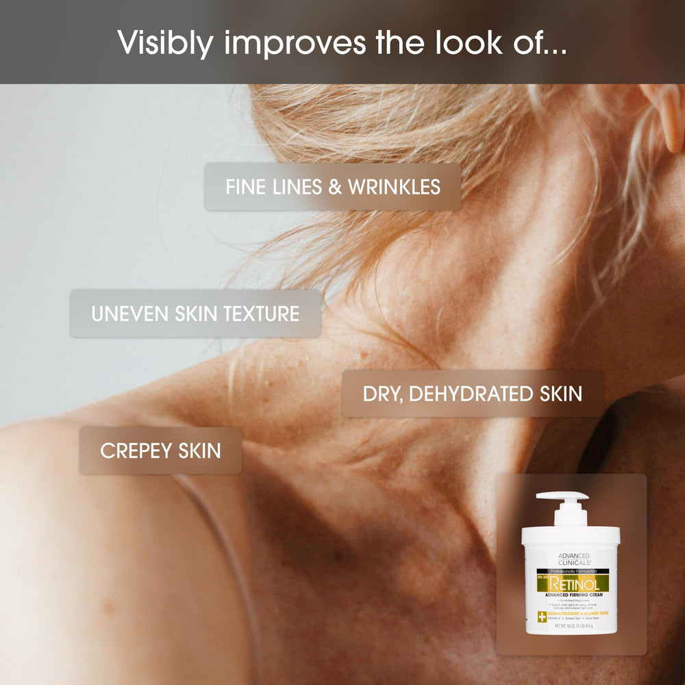 Close-up of Advanced Clinicals retinol body cream texture shows non-greasy feel