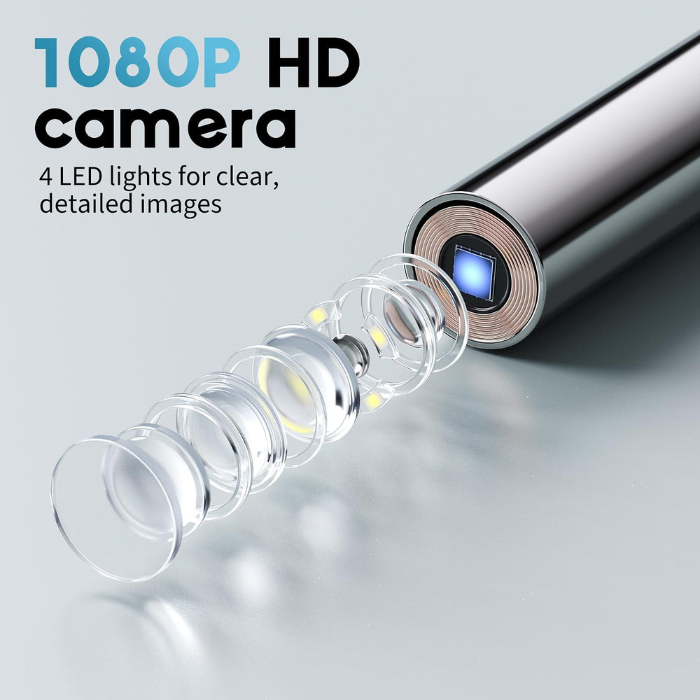Aertnelz otoscope IPS display enables real time viewing without a phone