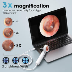 Aertnelz otoscope with adjustable magnification for precise checks