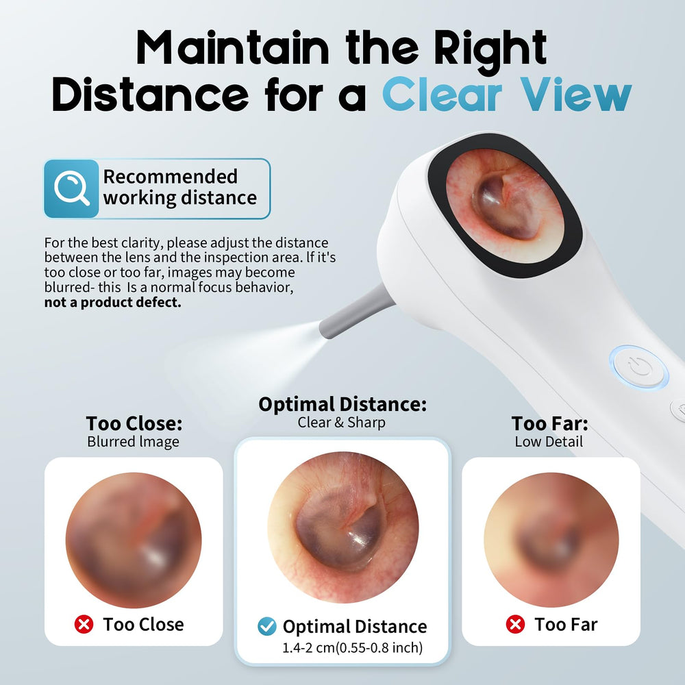 Aertnelz Otoscope package contents laid out