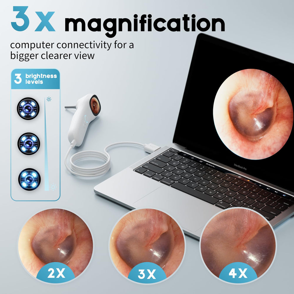 Aertnelz Otoscope connected to a PC for real‑time viewing