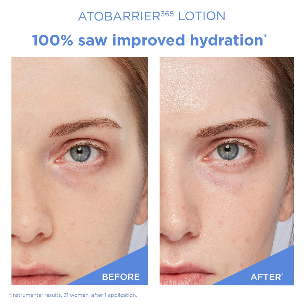 Hand applying moisturizer to illustrate easy daily use.