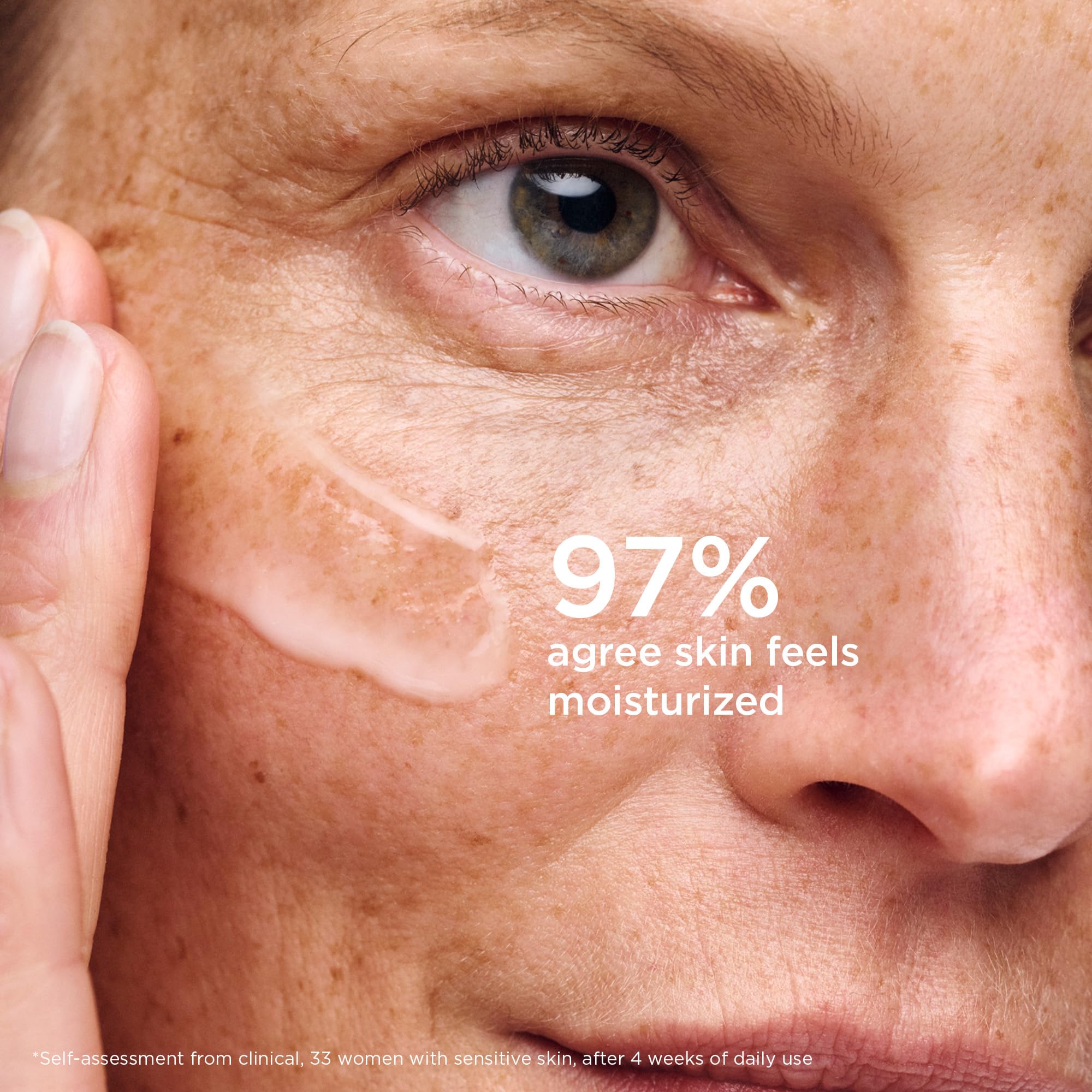 Skin after using AESTURA Hydro Essence appears dewy and hydrated.