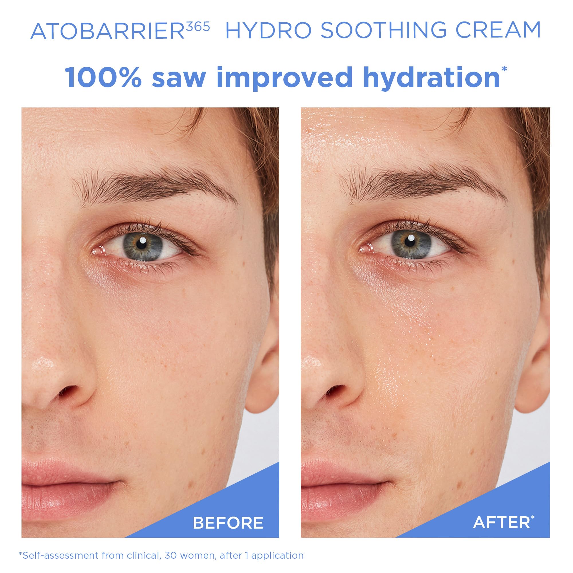 AESTURA ATOBARRIER365 hydro gel-cream face close-up with gentle, fragrance-free texture