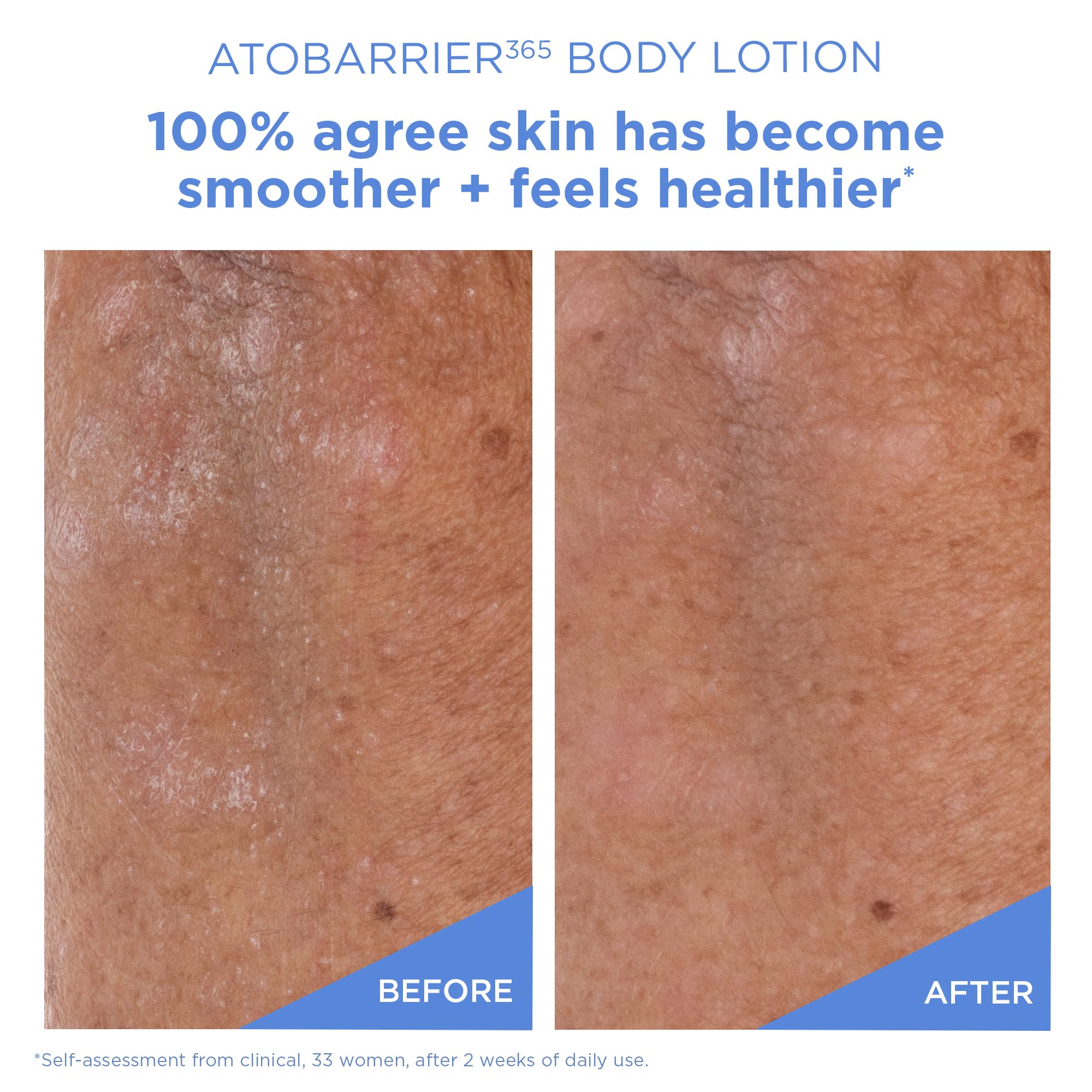 PHA exfoliation action in AESTURA ATOBARRIER365 display with gentle exfoliation benefits.