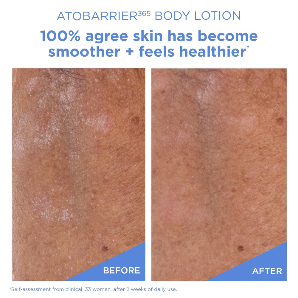 PHA exfoliation action in AESTURA ATOBARRIER365 display with gentle exfoliation benefits.