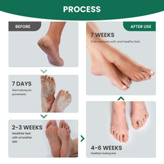 AIFUFAND foot-care routine application on clean feet for refreshed feel.