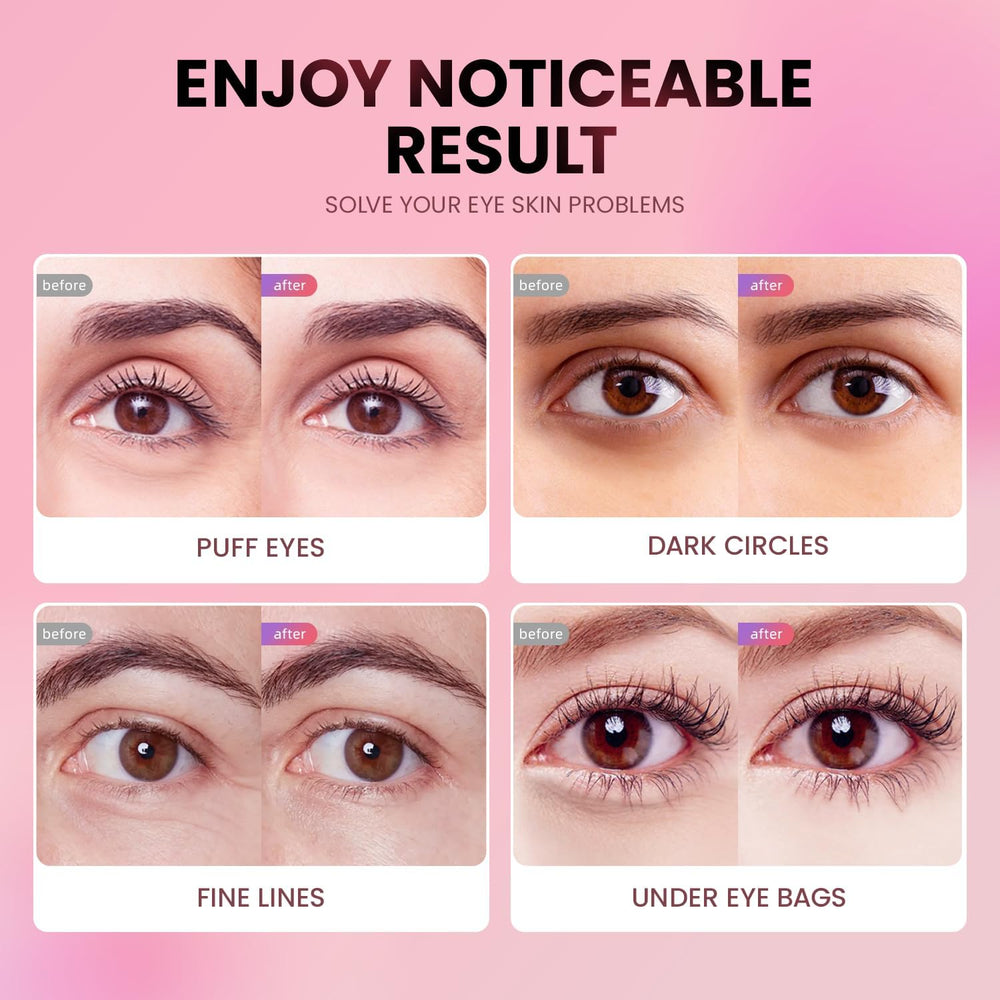 AILEORY vegan, paraben- and sulfate-free eye patches for gentle care