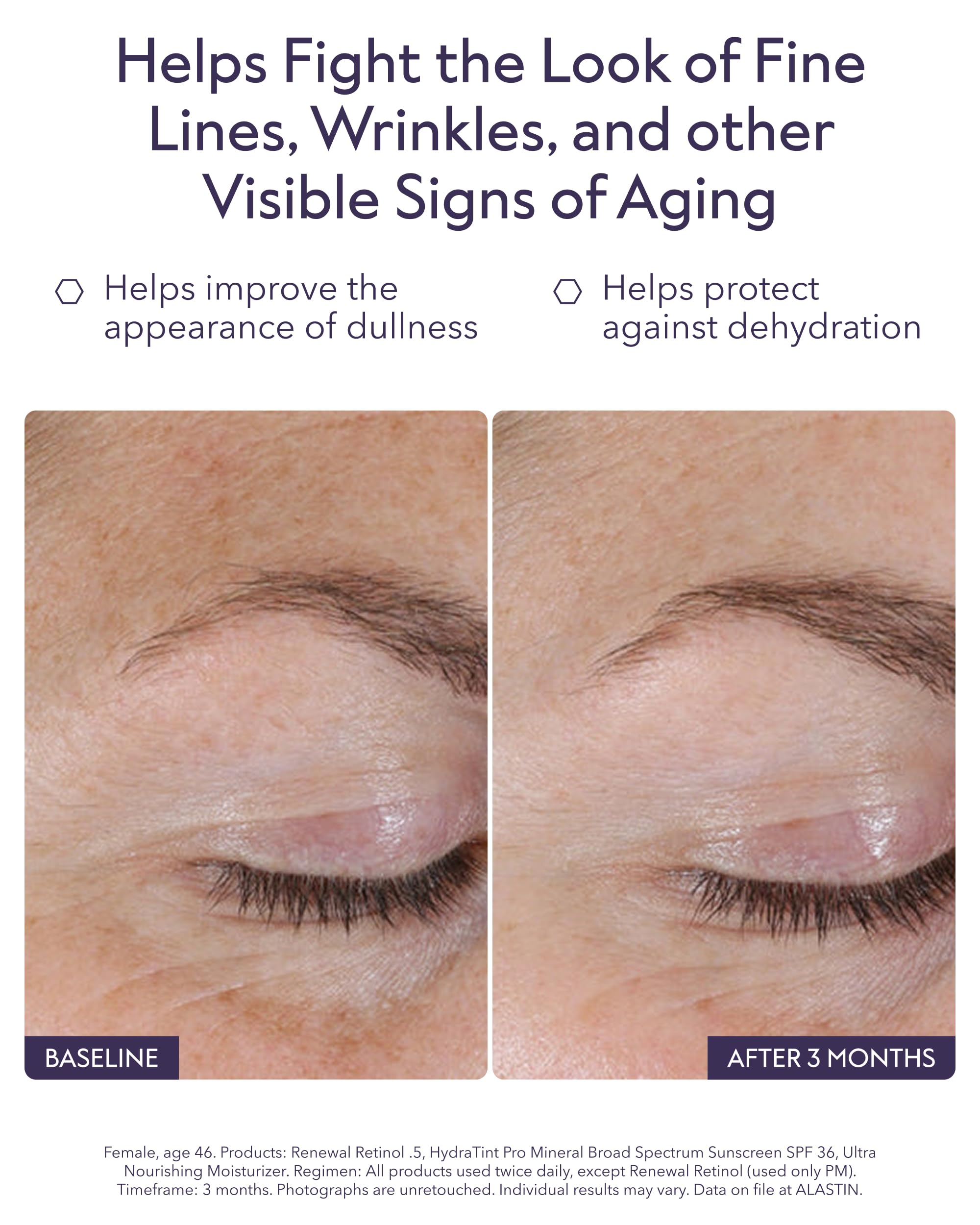 ALASTIN Renewal Retinol Serum label detail emphasizing lipid-encapsulated technology