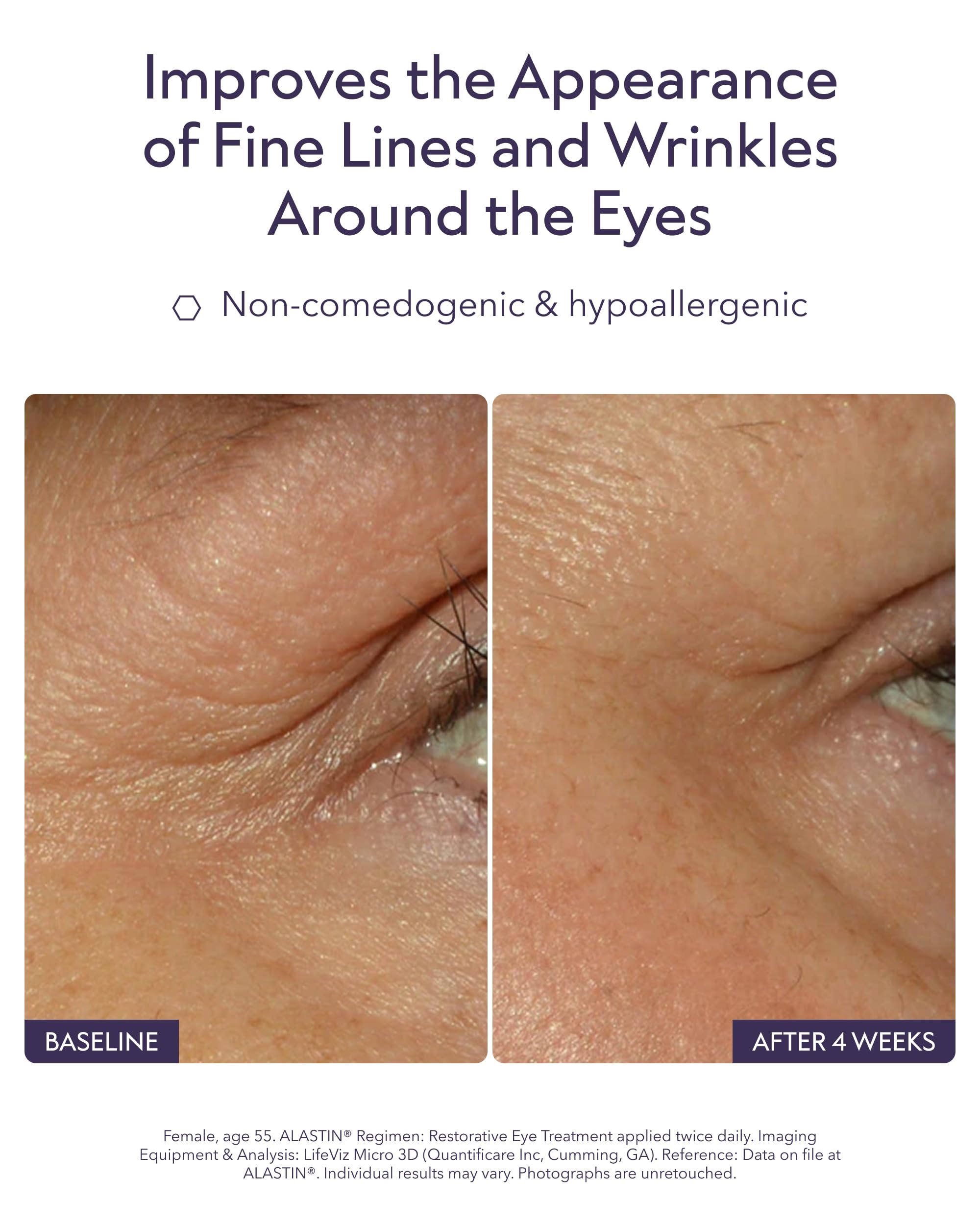 ALASTIN Skincare Restorative Eye Complex jar viewed from the side.