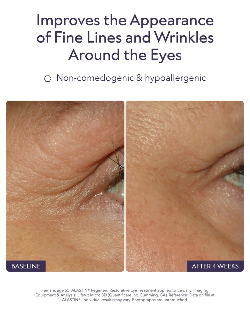 ALASTIN Skincare Restorative Eye Complex jar viewed from the side.