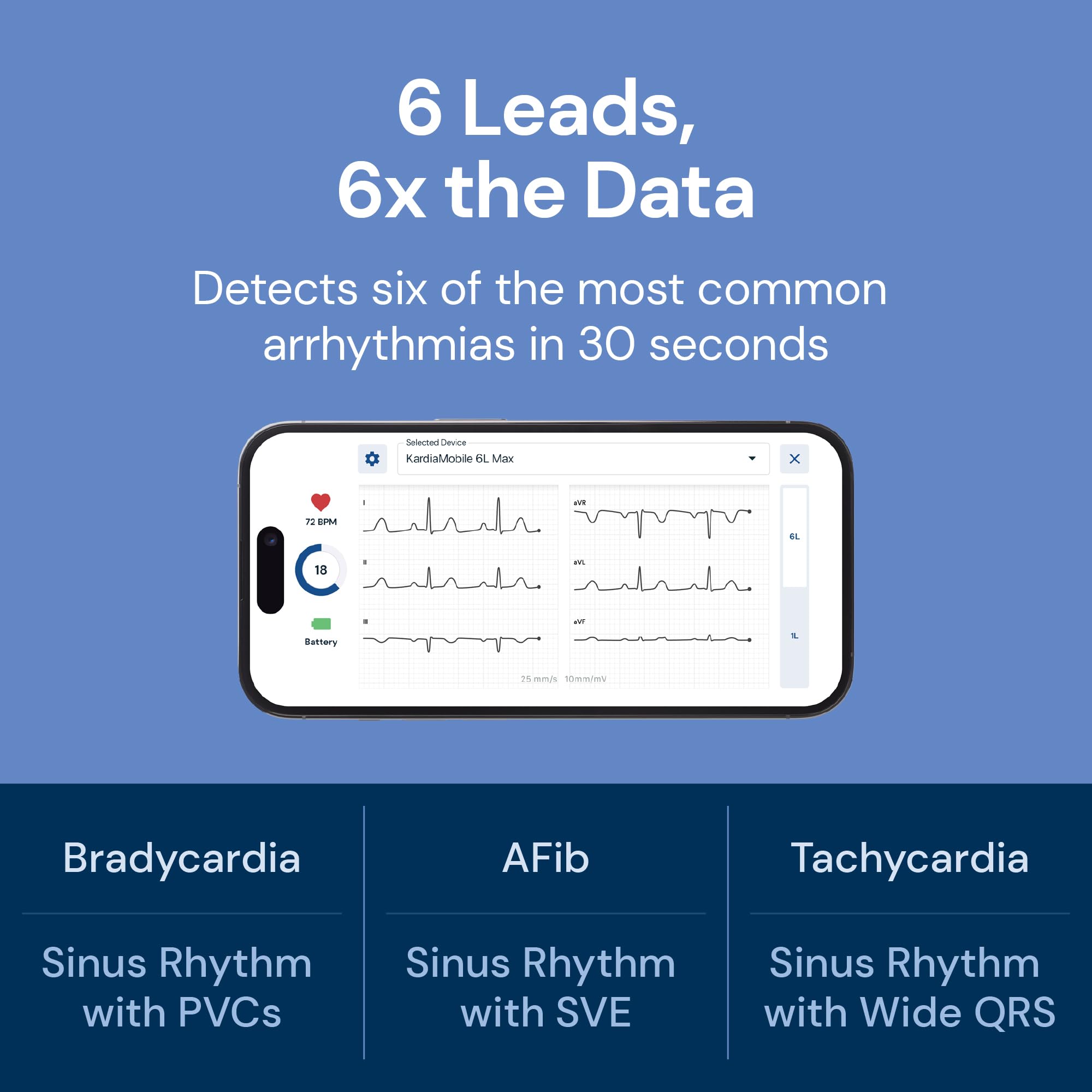 AliveCor KardiaMobile 6L Max compact size shown for pocket-ready monitoring.