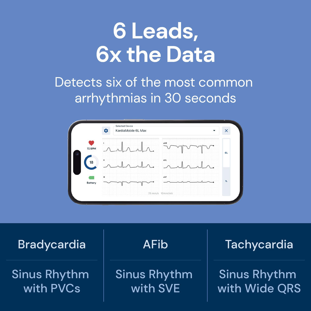 AliveCor KardiaMobile 6L Max compact size shown for pocket-ready monitoring.