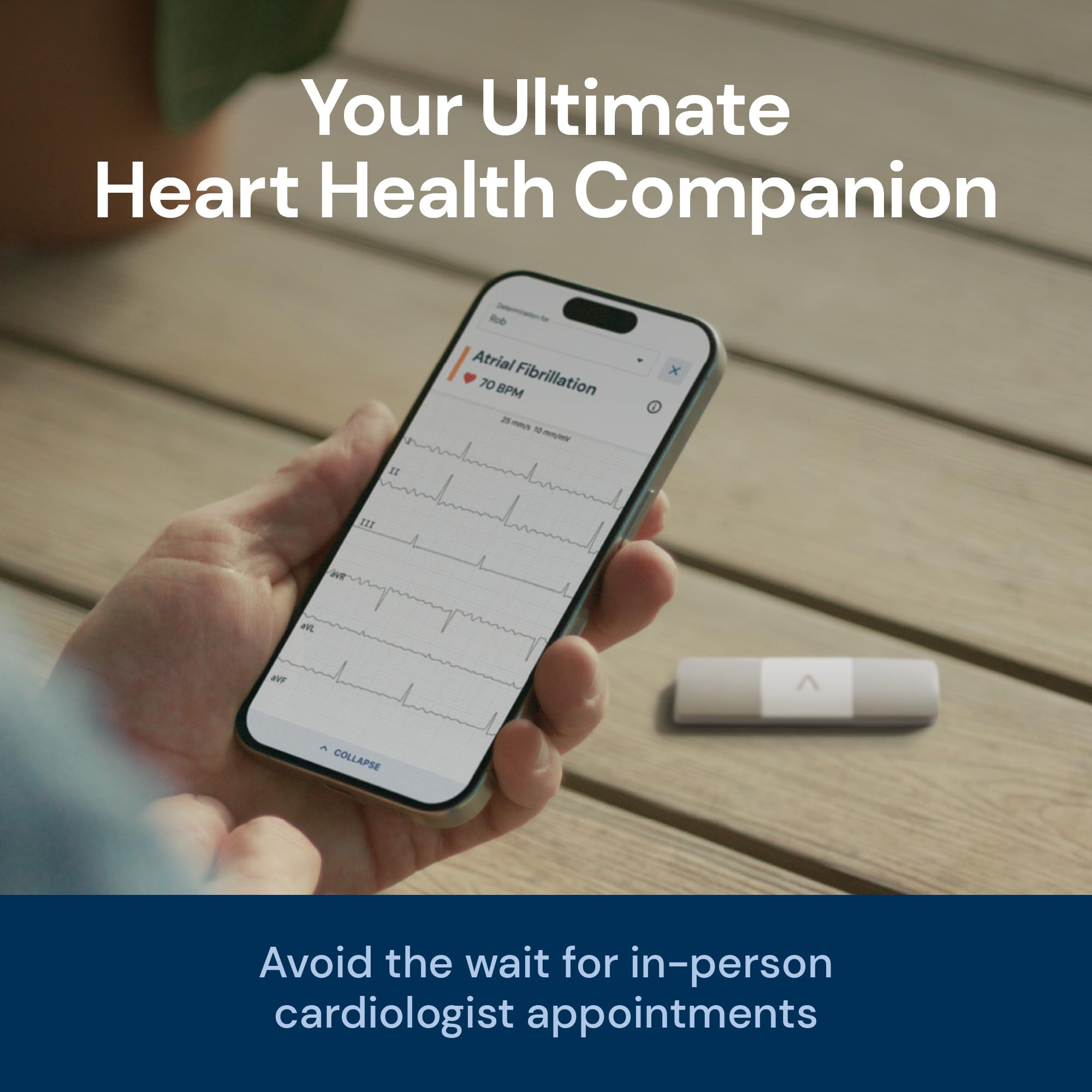AliveCor KardiaMobile 6L Max six-lead leads visualization for detailed rhythm view.