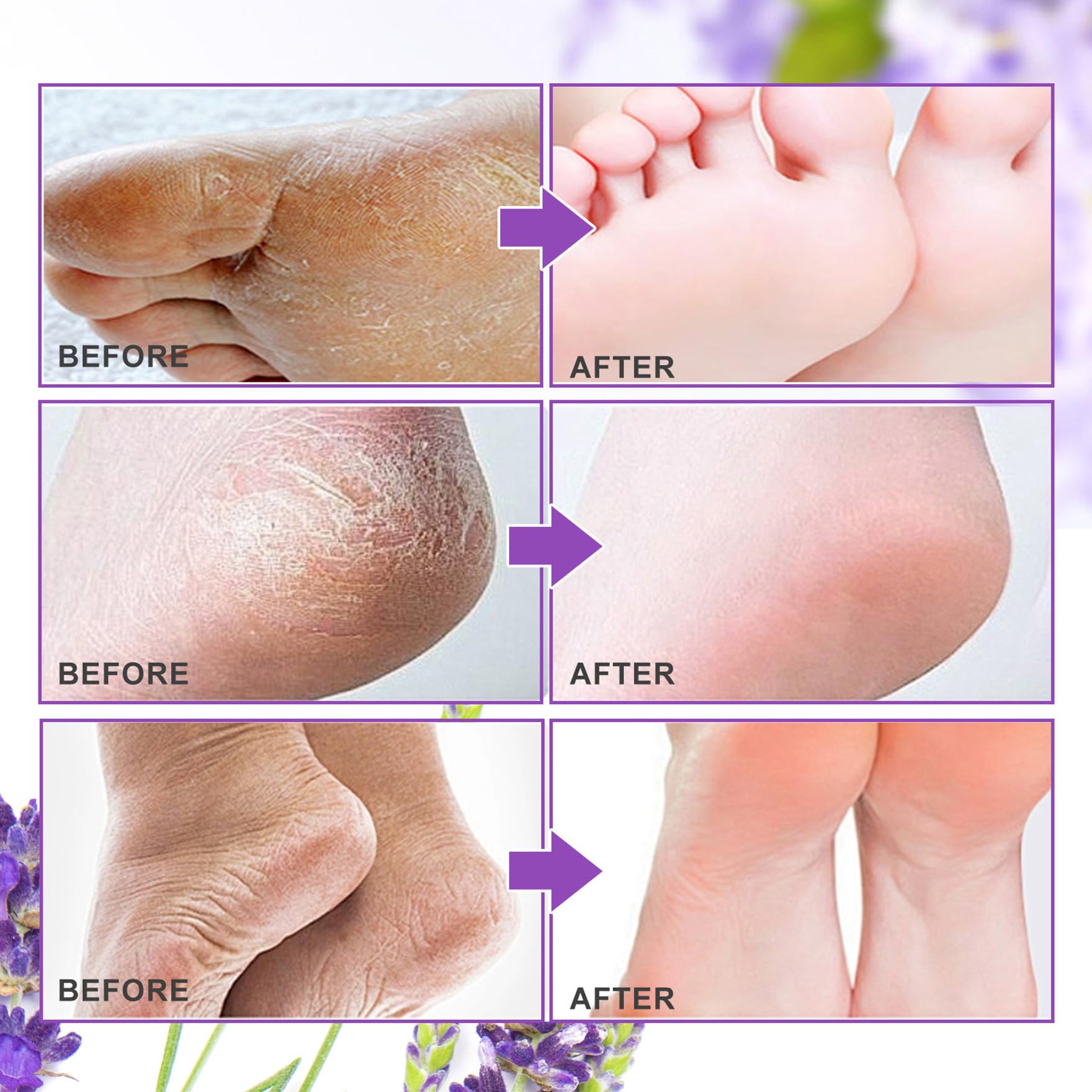 ALIVER Foot Peel Mask 3 Pack lavender packaging design highlights value