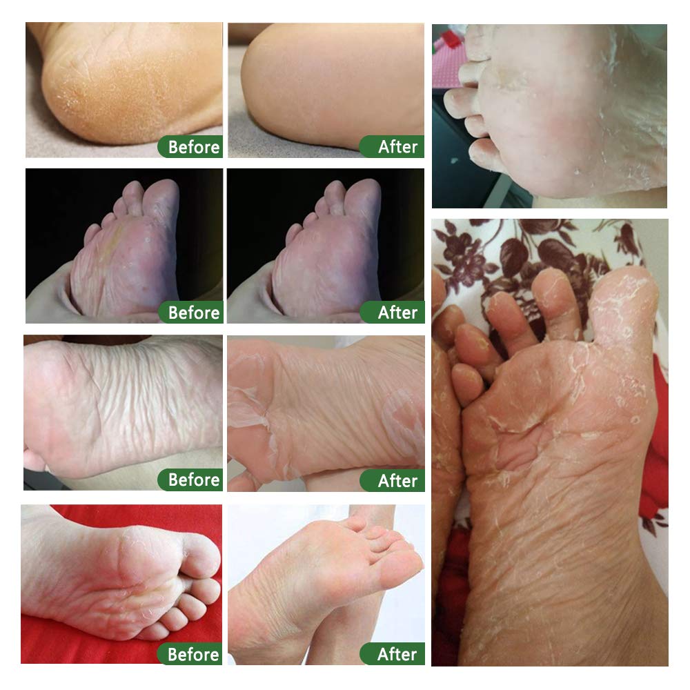 Suitable for men and women seeking at-home foot care with ALIVER.