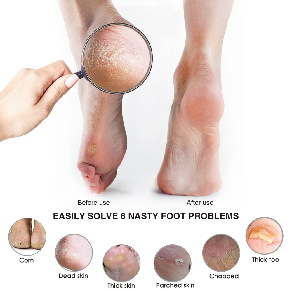 AM 8:00 foot file supports wet or dry use for versatile pedicure care