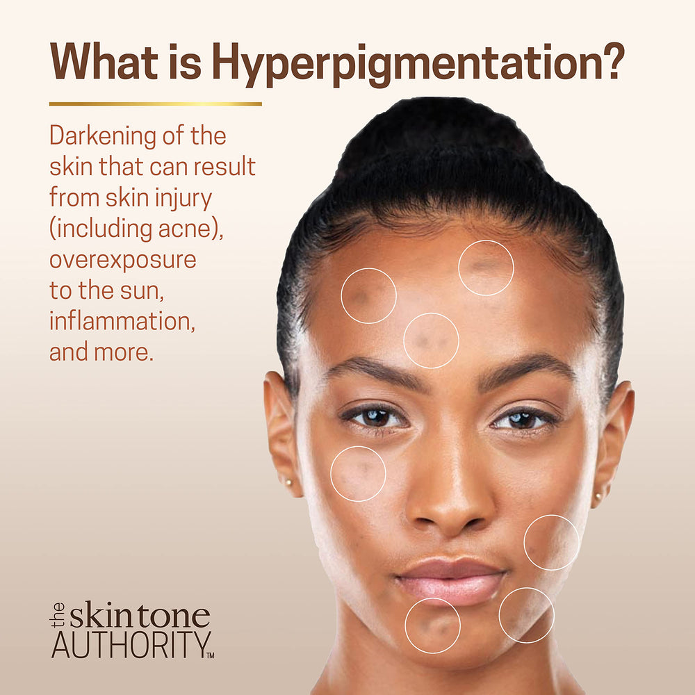 Ambi Even & Clear hyaluronic acid close-up highlighting hydration support.