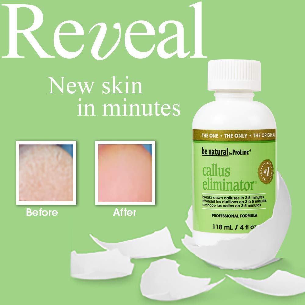 Applying ProLinc Callus Eliminator to callused areas for quick pedicure