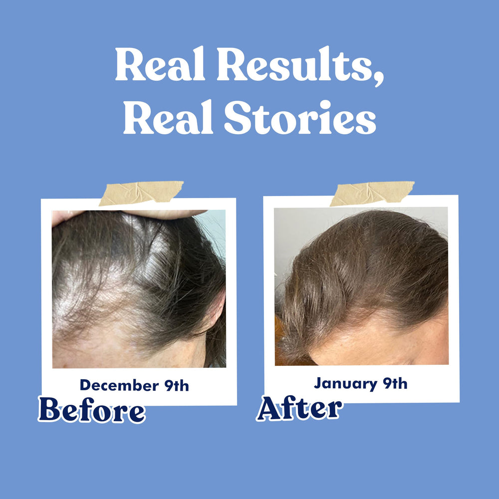American Standard Biotin is gluten-free and non-GMO for mindful shoppers.
