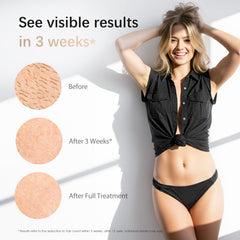 AMOTAOS IPL with cooling-contact view highlighting painless at-home sessions