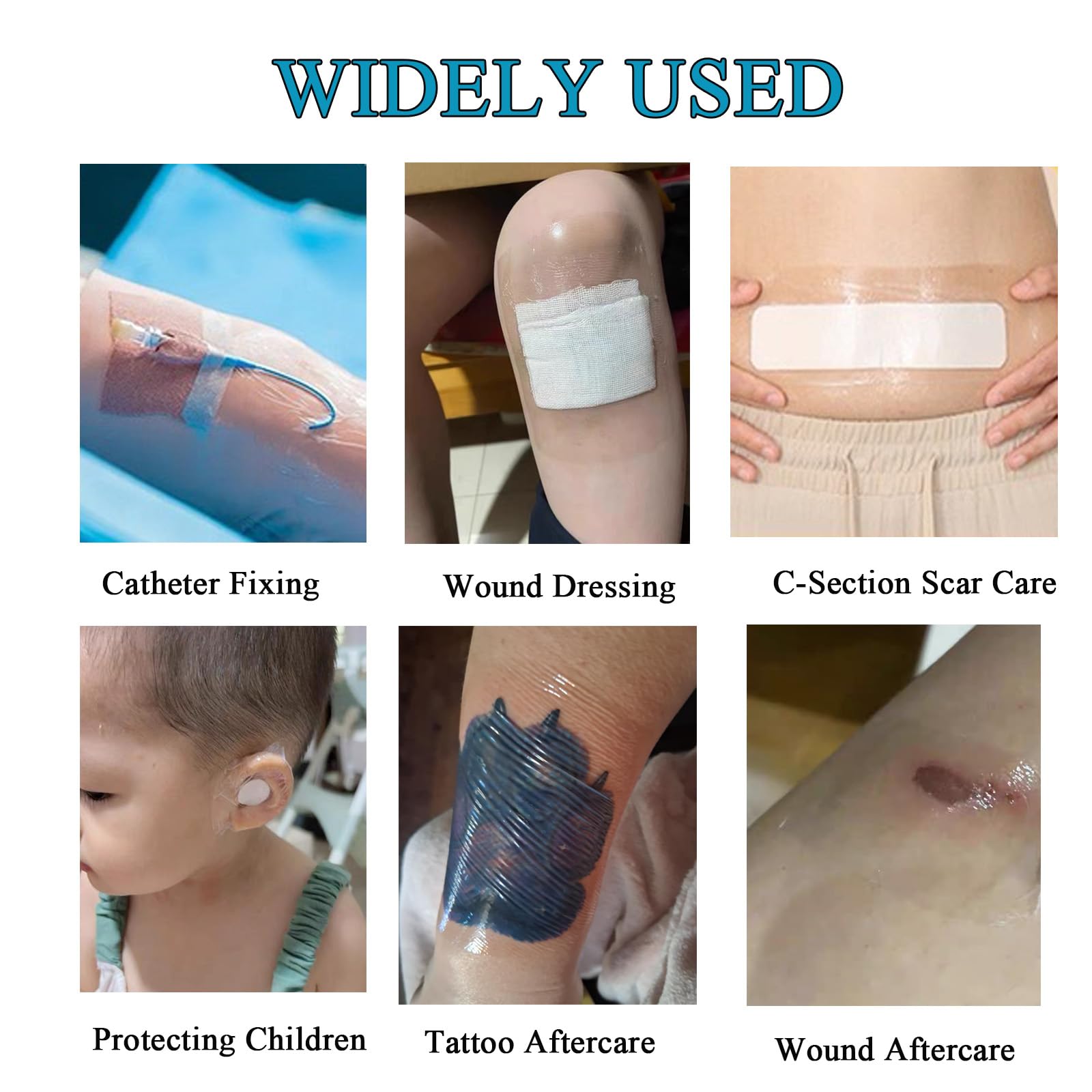 ANAMPION translucent PET-PU film keeps tattoo visible while healing