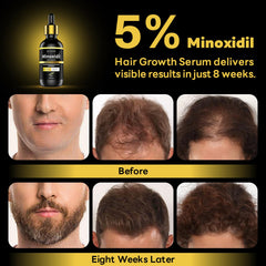 Andelusita minoxidil label closeup communicates trusted ingredients clearly.