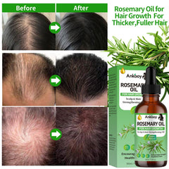 ANKOOY 3-pack Rosemary Oil complete set highlighting value and convenience.